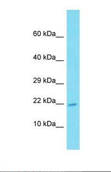 ATP6V0E2 Antibody - Western blot of Human Placenta. ATP6V0E2 antibody dilution 1.0 ug/ml.  This image was taken for the unconjugated form of this product. Other forms have not been tested.