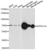 ATP6V1A1 / ATP6V1A Antibody - Western blot analysis of extracts of various cell lines, using ATP6V1A antibody at 1:1000 dilution. The secondary antibody used was an HRP Goat Anti-Rabbit IgG (H+L) at 1:10000 dilution. Lysates were loaded 25ug per lane and 3% nonfat dry milk in TBST was used for blocking. An ECL Kit was used for detection and the exposure time was 3min.