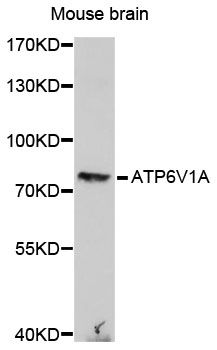 ATP6V1A1 / ATP6V1A Antibody - Western blot analysis of extracts of mouse brain , using ATP6V1A antibody at 1:1000 dilution. The secondary antibody used was an HRP Goat Anti-Rabbit IgG (H+L) at 1:10000 dilution. Lysates were loaded 25ug per lane and 3% nonfat dry milk in TBST was used for blocking. An ECL Kit was used for detection and the exposure time was 3min.