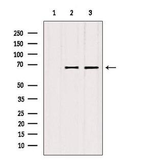 ATP6V1A1 / ATP6V1A Antibody - Western blot analysis of extracts of various samples using ATP6V1A antibody. Lane 1: rat brain treated with blocking peptide. Lane 2: rat brain; Lane 3: B16F10;