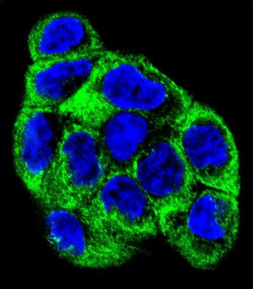 ATP6V1B1 Antibody - Confocal immunofluorescence of ATP6V1B1 Antibody with WiDr cell followed by Alexa Fluor 488-conjugated goat anti-rabbit lgG (green). DAPI was used to stain the cell nuclear (blue).