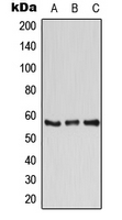 ATP6V1B1 Antibody - Western blot analysis of ATP6V1B1 expression in K562 (A); Raw264.7 (B); PC12 (C) whole cell lysates.