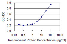 ATP6V1B1 Antibody - Detection limit for recombinant GST tagged ATP6V1B1 is 0.3 ng/ml as a capture antibody.