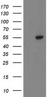 ATP6V1B1 Antibody - HEK293T cells were transfected with the pCMV6-ENTRY control (Left lane) or pCMV6-ENTRY ATP6V1B1 (Right lane) cDNA for 48 hrs and lysed. Equivalent amounts of cell lysates (5 ug per lane) were separated by SDS-PAGE and immunoblotted with anti-ATP6V1B1.