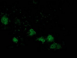 ATP6V1B1 Antibody - Anti-ATP6V1B1 mouse monoclonal antibody immunofluorescent staining of COS7 cells transiently transfected by pCMV6-ENTRY ATP6V1B1.