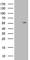 ATP6V1B1 Antibody - HEK293T cells were transfected with the pCMV6-ENTRY control (Left lane) or pCMV6-ENTRY ATP6V1B1 (Right lane) cDNA for 48 hrs and lysed. Equivalent amounts of cell lysates (5 ug per lane) were separated by SDS-PAGE and immunoblotted with anti-ATP6V1B1.