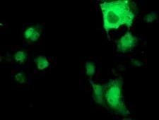 ATP6V1B1 Antibody - Anti-ATP6V1B1 mouse monoclonal antibody immunofluorescent staining of COS7 cells transiently transfected by pCMV6-ENTRY ATP6V1B1.