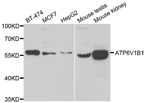 ATP6V1B1 Antibody - Western blot analysis of extracts of various cell lines.