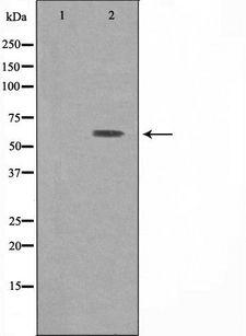 ATP6V1B1 Antibody - Western blot analysis of extracts of HepG2 cells using ATP6V1B1 antibody. The lane on the left is treated with the antigen-specific peptide.