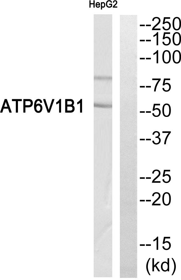 ATP6V1B1 Antibody - Western blot analysis of extracts from HepG2 cells, using ATP6V1B1 antibody.