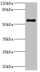 ATP6V1B2 Antibody - Western blot All lanes: ATP6V1B2 antibody at 5µg/ml + Hela whole cell lysate Secondary Goat polyclonal to rabbit IgG at 1/10000 dilution Predicted band size: 57 kDa Observed band size: 57 kDa