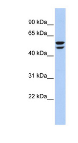 ATP6V1B2 Antibody - ATP6V1B2 antibody Western blot of 721_B cell lysate. This image was taken for the unconjugated form of this product. Other forms have not been tested.