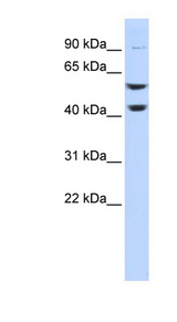 ATP6V1B2 Antibody - ATP6V1B2 antibody Western blot of HeLa lysate. This image was taken for the unconjugated form of this product. Other forms have not been tested.