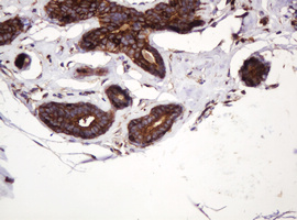 ATP6V1B2 Antibody - IHC of paraffin-embedded Human breast tissue using anti-ATP6V1B2 mouse monoclonal antibody.