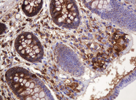 ATP6V1B2 Antibody - IHC of paraffin-embedded Human colon tissue using anti-ATP6V1B2 mouse monoclonal antibody.
