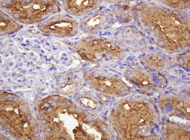 ATP6V1B2 Antibody - IHC of paraffin-embedded Human Kidney tissue using anti-ATP6V1B2 mouse monoclonal antibody.