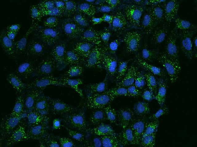 ATP6V1B2 Antibody - Immunofluorescence staining of ATP6V1B2 in U2OS cells. Cells were fixed with 4% PFA, permeabilzed with 0.1% Triton X-100 in PBS, blocked with 10% serum, and incubated with rabbit anti-Human ATP6V1B2 polyclonal antibody (dilution ratio 1:100) at 4°C overnight. Then cells were stained with the Alexa Fluor 488-conjugated Goat Anti-rabbit IgG secondary antibody (green) and counterstained with DAPI (blue). Positive staining was localized to Cytoplasm.