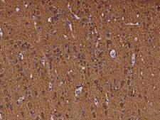 ATP6V1B2 Antibody - Immunochemical staining of human ATP6V1B2 in human brain with rabbit polyclonal antibody at 1:100 dilution, formalin-fixed paraffin embedded sections.