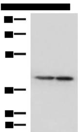 ATP6V1C1 Antibody - Western blot analysis of Human cerebella tissue and Human cerebrum tissue lysates  using ATP6V1C1 Polyclonal Antibody at dilution of 1:500