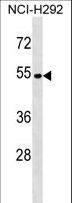 ATP6V1C2 Antibody - ATP6V1C2 Antibody western blot of NCI-H292 cell line lysates (35 ug/lane). The ATP6V1C2 antibody detected the ATP6V1C2 protein (arrow).