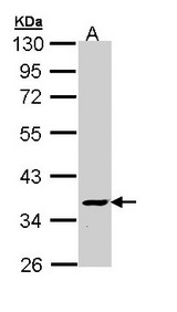 ATP6V1C2 Antibody - Sample (30 ug of whole cell lysate). A: Molt-4 . 10% SDS PAGE. ATP6V1C2 antibody diluted at 1:1000.