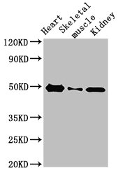 ATP6V1C2 Antibody - Positive Western Blot detected in Rat heart tissue, Rat skeletal muscle, Mouse kidney tissue. All lanes: ATP6V1C2 antibody at 3.4 µg/ml Secondary Goat polyclonal to rabbit IgG at 1/50000 dilution. Predicted band size: 49, 44 KDa. Observed band size: 49 KDa
