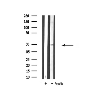 ATP6V1C2 Antibody - Western blot analysis of extracts of HepG2 cells using ATP6V1C2 antibody.