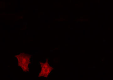 ATP6V1C2 Antibody - Staining HepG2 cells by IF/ICC. The samples were fixed with PFA and permeabilized in 0.1% Triton X-100, then blocked in 10% serum for 45 min at 25°C. The primary antibody was diluted at 1:200 and incubated with the sample for 1 hour at 37°C. An Alexa Fluor 594 conjugated goat anti-rabbit IgG (H+L) antibody, diluted at 1/600, was used as secondary antibody.