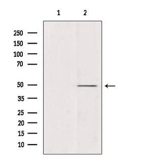 ATP6V1C2 Antibody - Western blot analysis of extracts of various samples using ATP6V1C2 antibody. Lane 1: 293 treated with blocking peptide. Lane 2: 293; Lane 3: HeLa;