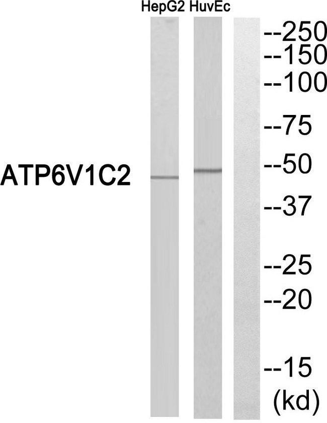 ATP6V1C2 Antibody - Western blot analysis of extracts from HepG2 cells and HUVEC cells, using ATP6V1C2 antibody.