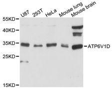 ATP6V1D / V-ATPase subunit D Antibody - Western blot analysis of extracts of various cell lines, using ATP6V1D antibody at 1:3000 dilution. The secondary antibody used was an HRP Goat Anti-Rabbit IgG (H+L) at 1:10000 dilution. Lysates were loaded 25ug per lane and 3% nonfat dry milk in TBST was used for blocking. An ECL Kit was used for detection and the exposure time was 60s.