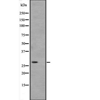 ATP6V1D / V-ATPase subunit D Antibody - Western blot analysis of ATP6V1D expression in HeLa cells lysate. The lane on the left is treated with the antigen-specific peptide.