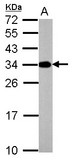 ATP6V1E2 Antibody - Sample (50 ug of whole cell lysate) A: mouse brain 12% SDS PAGE ATP6V1E2 antibody diluted at 1:10000