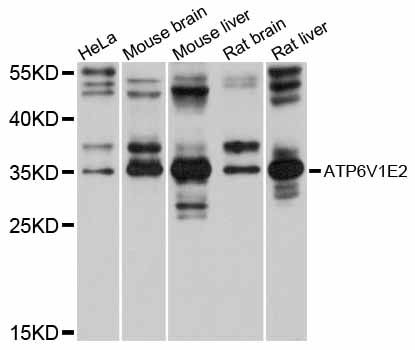 ATP6V1E2 Antibody - Western blot analysis of extracts of various cell lines, using ATP6V1E2 antibody at 1:1000 dilution. The secondary antibody used was an HRP Goat Anti-Rabbit IgG (H+L) at 1:10000 dilution. Lysates were loaded 25ug per lane and 3% nonfat dry milk in TBST was used for blocking. An ECL Kit was used for detection and the exposure time was 60s.