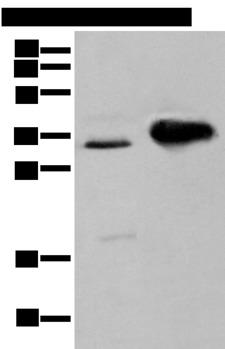 ATP6V1E2 Antibody - Western blot analysis of TM4 cell and Mouse brain tissue  using ATP6V1E2 Polyclonal Antibody at dilution of 1:400