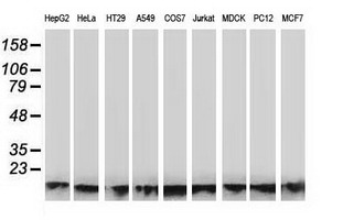 ATP6V1F Antibody - Western blot of extracts (35 ug) from 9 different cell lines by using anti-ATP6V1F monoclonal antibody.