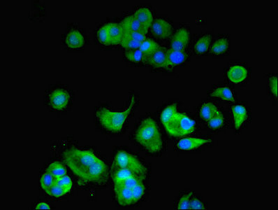 ATP6V1F Antibody - Immunofluorescent analysis of MCF-7 cells using ATP6V1F Antibody at dilution of 1:100 and Alexa Fluor 488-congugated AffiniPure Goat Anti-Rabbit IgG(H+L)