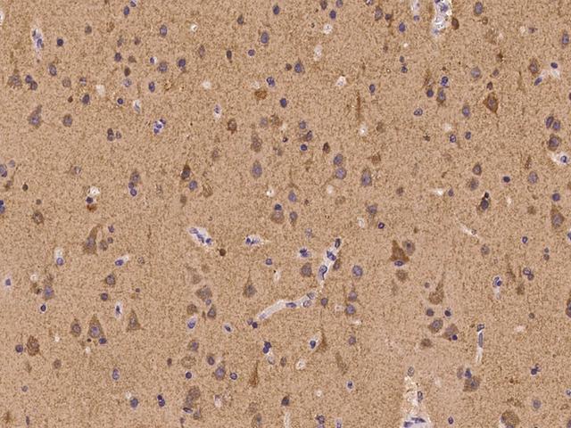 ATP6V1F Antibody - Immunochemical staining of human ATP6V1F in human brain with rabbit polyclonal antibody at 1:100 dilution, formalin-fixed paraffin embedded sections.