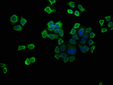 ATP6V1G1 / ATP6J Antibody - Immunofluorescence staining of PC-3 cells with ATP6V1G1 Antibody at 1:133, counter-stained with DAPI. The cells were fixed in 4% formaldehyde, permeabilized using 0.2% Triton X-100 and blocked in 10% normal Goat Serum. The cells were then incubated with the antibody overnight at 4°C. The secondary antibody was Alexa Fluor 488-congugated AffiniPure Goat Anti-Rabbit IgG(H+L).