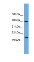 ATP6V1G2 Antibody - ATP6V1G2 antibody Western blot of Fetal Brain lysate. This image was taken for the unconjugated form of this product. Other forms have not been tested.