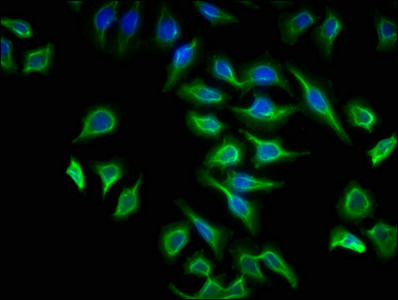 ATP6V1G2 Antibody - Immunofluorescence staining of A549 cells with ATP6V1G2 Antibody at 1:133, counter-stained with DAPI. The cells were fixed in 4% formaldehyde, permeabilized using 0.2% Triton X-100 and blocked in 10% normal Goat Serum. The cells were then incubated with the antibody overnight at 4°C. The secondary antibody was Alexa Fluor 488-congugated AffiniPure Goat Anti-Rabbit IgG(H+L).