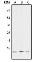ATP6V1G3 Antibody - Western blot analysis of ATP6V1G3 expression in HEK293T (A); NIH3T3 (B); PC12 (C) whole cell lysates.
