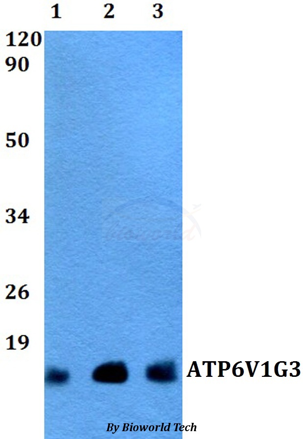ATP6V1G3 Antibody - Western blot of ATP6V1G3 antibody at 1:500 dilution. Lane 1: HEK293T whole cell lysate. Lane 2: NIH-3T3 whole cell lysate. Lane 3: PC12 whole cell lysate.