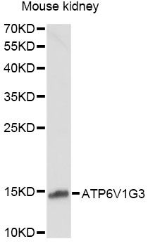 ATP6V1G3 Antibody - Western blot analysis of extracts of mouse kidney, using ATP6V1G3 antibody at 1:1000 dilution. The secondary antibody used was an HRP Goat Anti-Rabbit IgG (H+L) at 1:10000 dilution. Lysates were loaded 25ug per lane and 3% nonfat dry milk in TBST was used for blocking. An ECL Kit was used for detection and the exposure time was 90s.