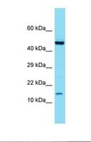 ATP6V1G3 Antibody - Western blot of Mouse Spleen. Atp6v1g3 antibody dilution 1.0 ug/ml.  This image was taken for the unconjugated form of this product. Other forms have not been tested.