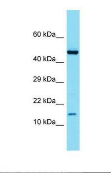 ATP6V1G3 Antibody - Western blot of Mouse Spleen. Atp6v1g3 antibody dilution 1.0 ug/ml.  This image was taken for the unconjugated form of this product. Other forms have not been tested.