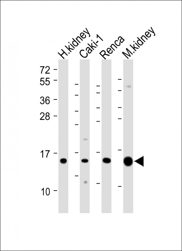 ATP6V1G3 Antibody - All lanes: Anti-ATP6V1G3 Antibody (N-Term) at 1:2000 dilution Lane 1: Human kidney lysate Lane 2: Caki-1 whole cell lysate Lane 3: Renca whole cell lysate Lane 4: Mouse kidney lysate Lysates/proteins at 20 µg per lane. Secondary Goat Anti-Rabbit IgG, (H+L), Peroxidase conjugated at 1/10000 dilution. Predicted band size: 14 kDa Blocking/Dilution buffer: 5% NFDM/TBST.