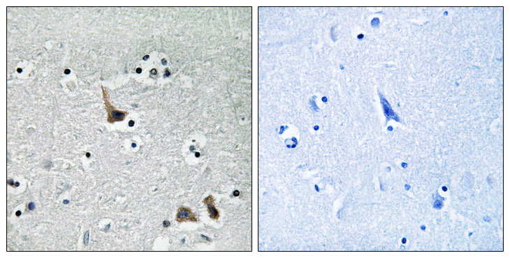 ATP6V1H Antibody - Immunohistochemistry analysis of paraffin-embedded human brain tissue, using ATP6V1H Antibody. The picture on the right is blocked with the synthesized peptide.