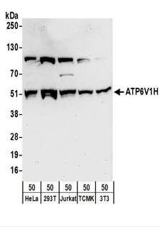 ATP6V1H Antibody - Detection of Human and Mouse ATP6V1H by Western Blot. Samples: Whole cell lysate (50 ug) from HeLa, 293T, Jurkat, mouse TCMK-1, and mouse NIH3T3 cells. Antibodies: Affinity purified rabbit anti-ATP6V1H antibody used for WB at 1 ug/ml. Detection: Chemiluminescence with an exposure time of 30 seconds.