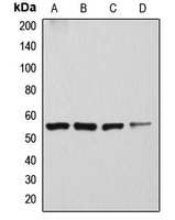 ATP6V1H Antibody - Western blot analysis of ATP6V1H expression in Caki1 (A); SKNSH (B); rat kidney (C); mouse brain (D) whole cell lysates.